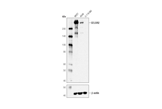 Western Blotting Image 1: CELSR2 (D2M9H) XP® Rabbit mAb (BSA and Azide Free)