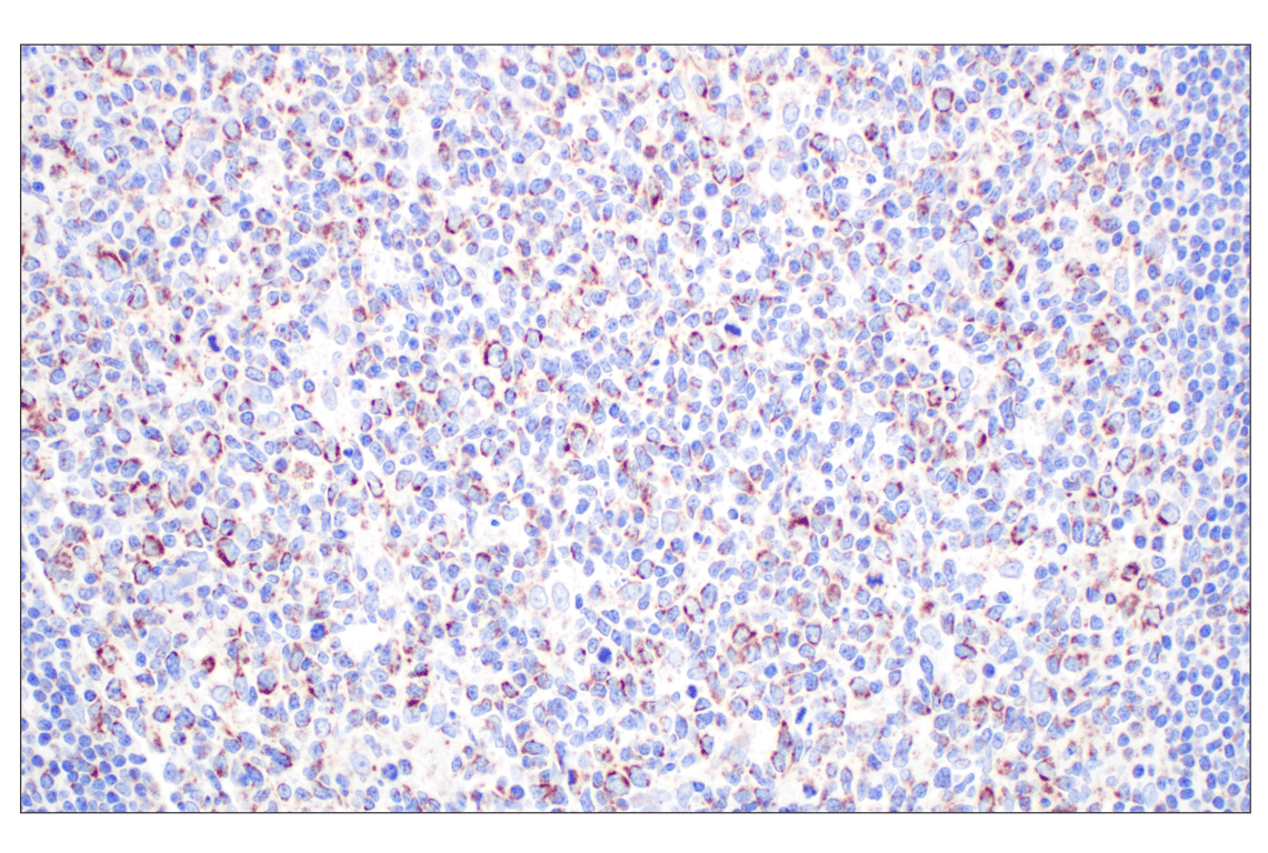 Immunohistochemistry Image 6: GCDH (F2P2M) Rabbit mAb