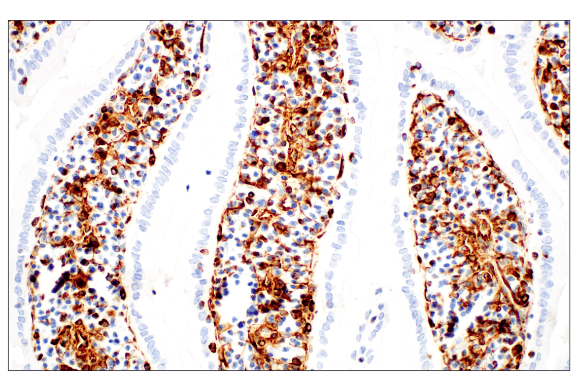 Immunohistochemistry Image 5: Vimentin (D21H3) XP<sup>®</sup> Rabbit mAb (BSA and Azide Free)