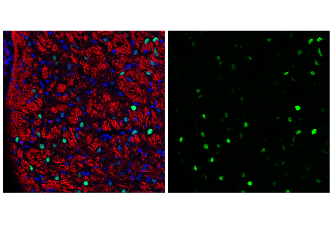 Immunofluorescence Image 2: c-Fos (9F6) Rabbit mAb