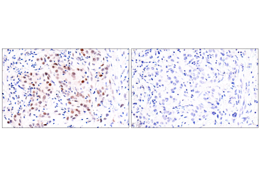 Immunohistochemistry Image 10: Bcl-3 (E4D4K) Rabbit mAb