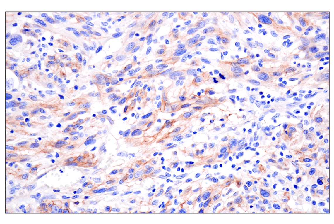 Immunohistochemistry Image 3: LRRC15 (E4X8J) Rabbit mAb