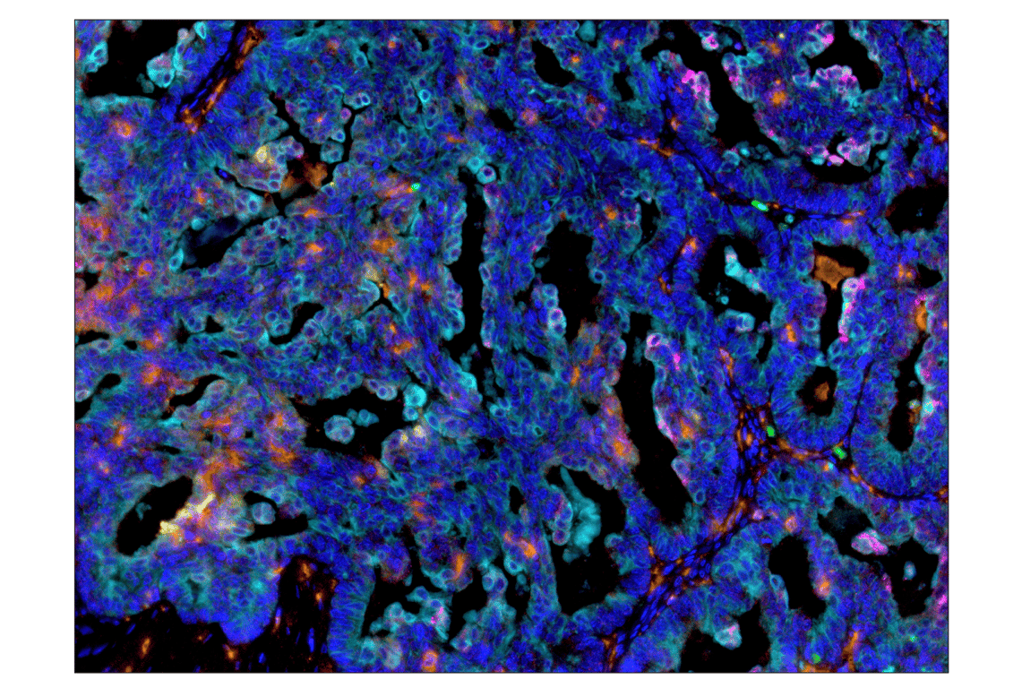 Immunohistochemistry Image 5: PD-L1 (E1L3N<sup>®</sup>) XP<sup>®</sup> Rabbit mAb