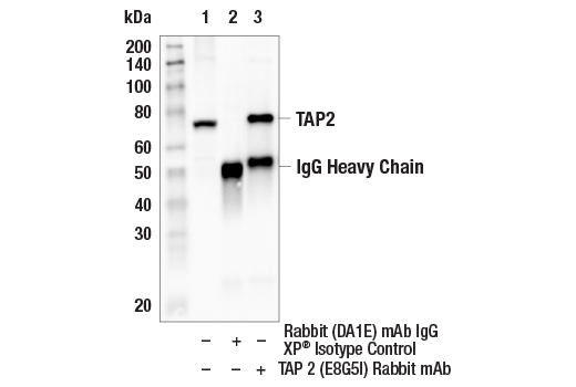 undefined Image 5: MHC Class I Antigen Processing and Presentation Antibody Sampler Kit