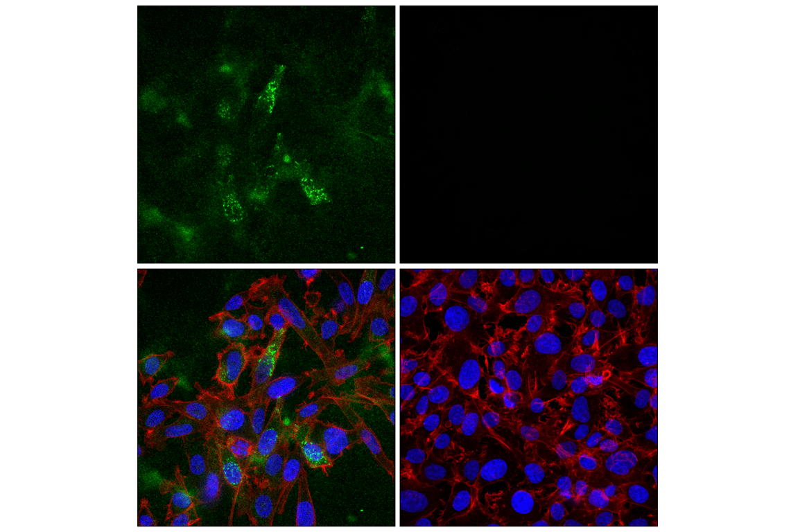Immunofluorescence Image 1: DKK1 (F1D4I) Rabbit mAb