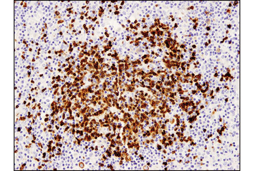 Immunohistochemistry Image 1: CD79A (D1X5C) XP<sup>®</sup> Rabbit mAb (BSA and Azide Free)