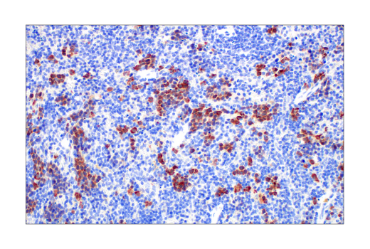 Immunohistochemistry Image 6: Asparagine Synthetase (E6C2C) XP<sup>®</sup> Rabbit mAb (BSA and Azide Free)