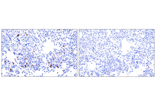 Immunohistochemistry Image 5: IL-2Rα/CD25 (E9W2J) XP<sup>®</sup> Rabbit mAb