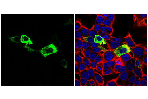 undefined Image 8: SARS-CoV-2 Virus-Host Interaction Antibody Sampler Kit