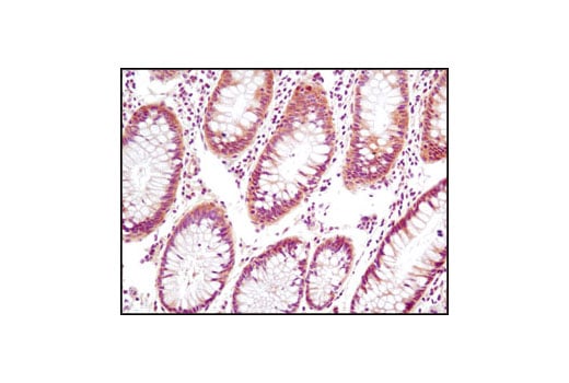 Immunohistochemistry Image 2: PTEN (D4.3) XP<sup>®</sup> Rabbit mAb (BSA and Azide Free)