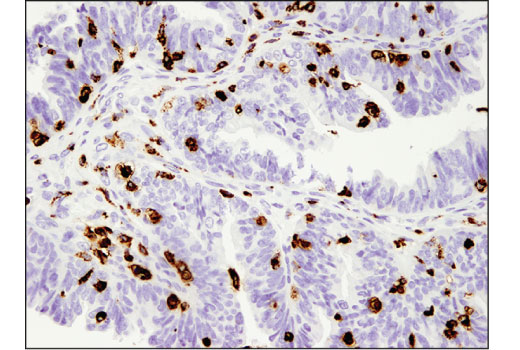 undefined Image 21: Microglia Neurodegeneration Module Antibody Sampler Kit