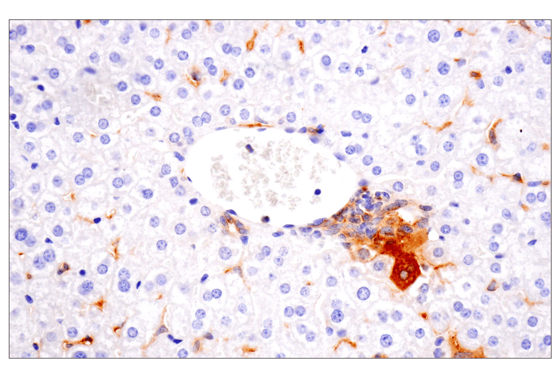 Immunohistochemistry Image 7: CD14 (D1U2Y) Rabbit mAb