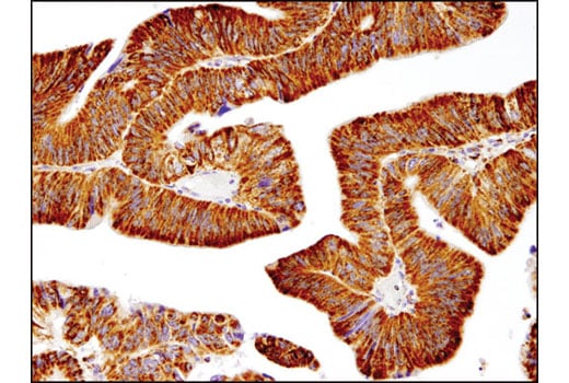 Immunohistochemistry Image 2: SOD2 (D3X8F) XP<sup>®</sup> Rabbit mAb