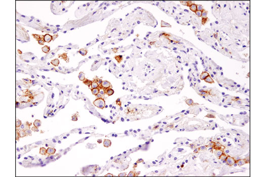 undefined Image 53: Human Exhausted CD8<sup>+</sup> T Cell IHC Antibody Sampler Kit