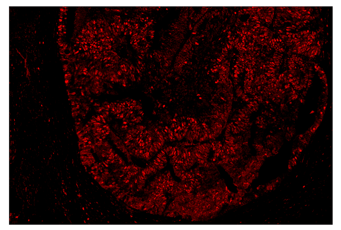 Immunohistochemistry Image 1: PCNA (D3H8P) & CO-0090-594 SignalStar<sup>™</sup> Oligo-Antibody Pair