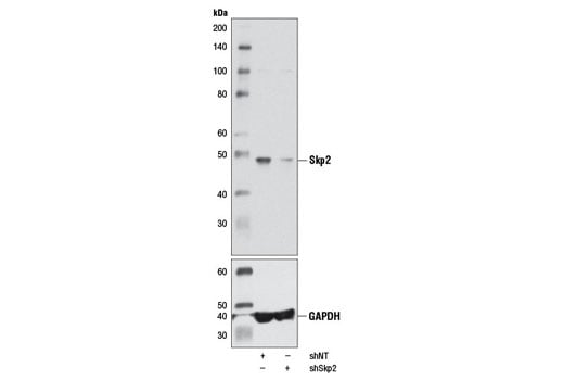 Western Blotting Image 3: Skp2 (D3G5) XP<sup>®</sup> Rabbit mAb