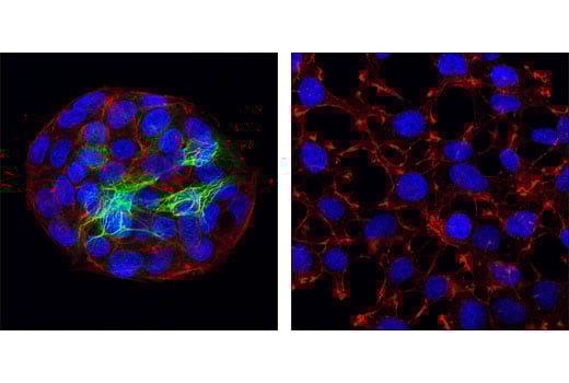 Immunofluorescence Image 1: Keratin 18 (DC10) Mouse mAb (BSA and Azide Free)