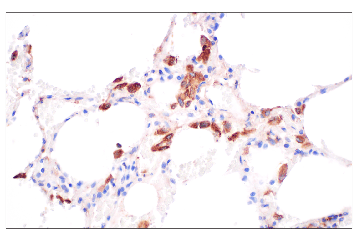Immunohistochemistry Image 3: GLIPR2 (F7H7V) Rabbit mAb