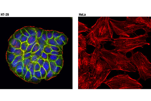 Immunofluorescence Image 1: EpCAM (D4K8R) XP<sup>®</sup> Rabbit mAb (BSA and Azide Free)