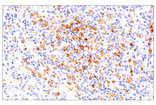 Immunohistochemistry Image 6: GM-CSF Receptor α (E8Z3S) Rabbit mAb