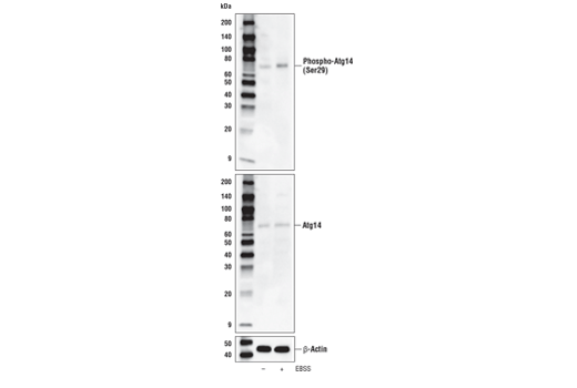undefined Image 30: ULK1 Substrate Antibody Sampler Kit