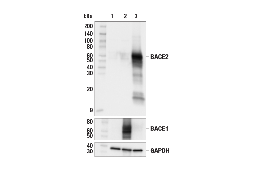 Western Blotting Image 2: BACE2 (E3Y9Q) Rabbit mAb