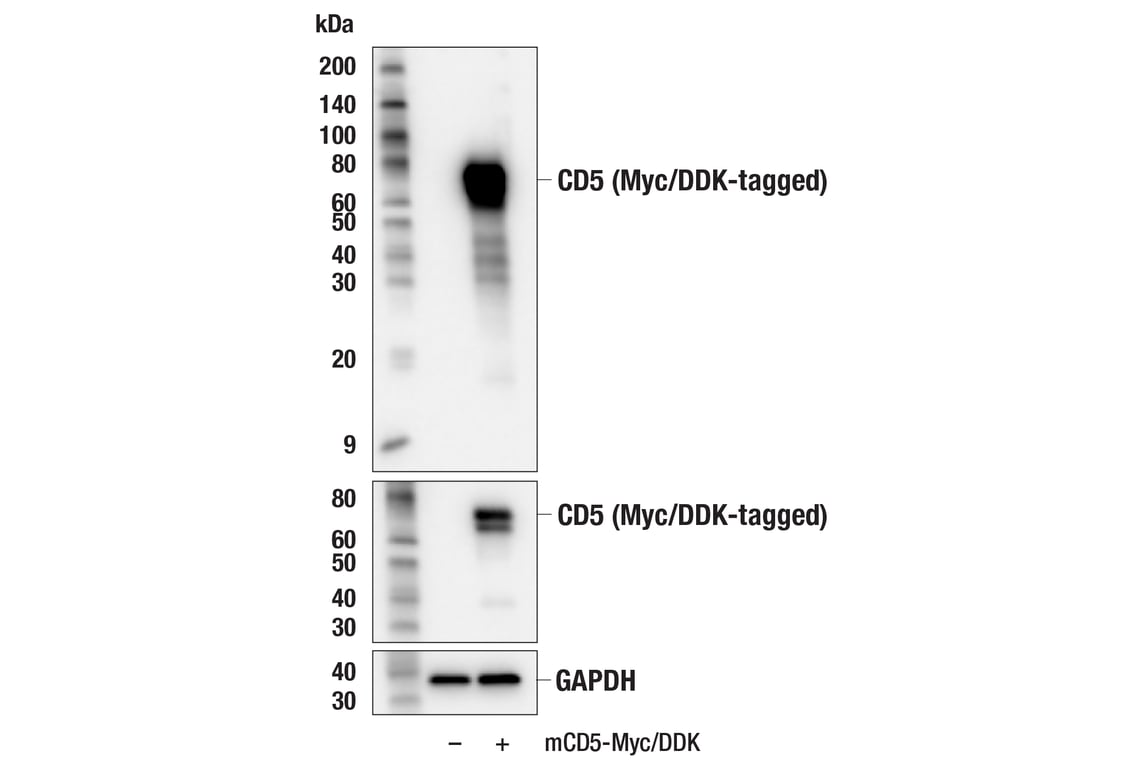 Western Blotting Image 2: CD5 (E6N9S) Rabbit mAb