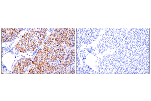 Immunohistochemistry Image 4: S100A1 (4C4.9) Mouse mAb
