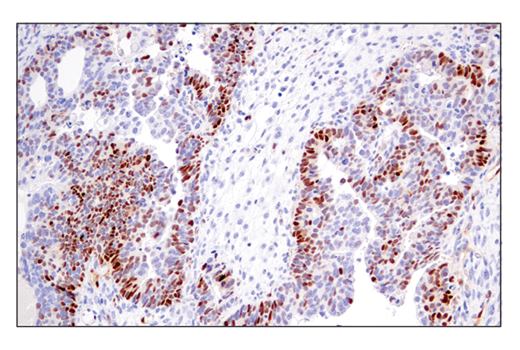 Immunohistochemistry Image 5: Cyclin D1 (E3P5S) XP<sup>®</sup> Rabbit mAb