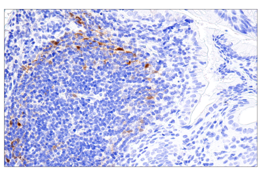 Immunohistochemistry Image 6: Parvalbumin (E8N2U) XP<sup>®</sup> Rabbit mAb