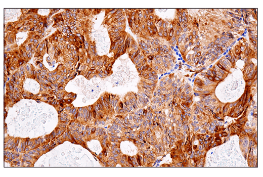 Immunohistochemistry Image 2: APP (E3F3P) Rabbit mAb