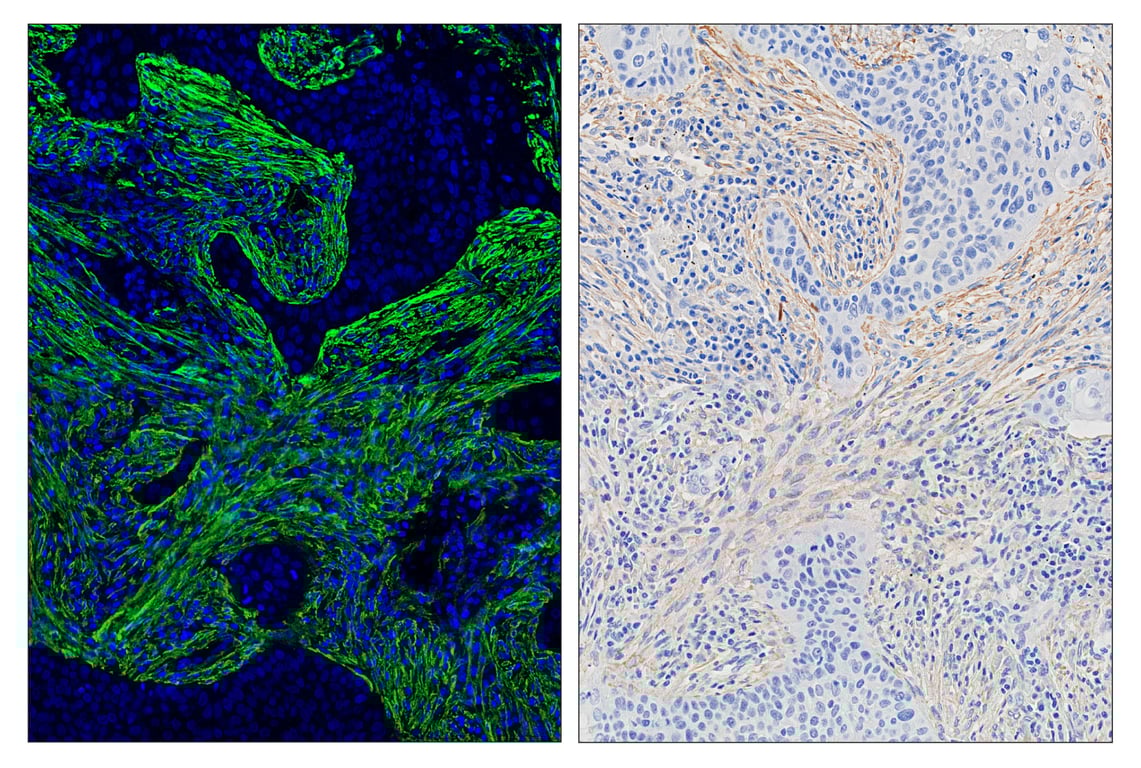 Immunohistochemistry Image 7: α-Smooth Muscle Actin (D4K9N) & CO-0024-488 SignalStar<sup>™</sup> Oligo-Antibody Pair