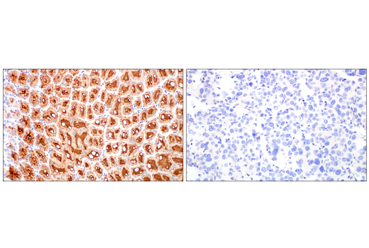 Immunohistochemistry Image 3: MUC5AC (E9V1O) XP<sup>®</sup> Rabbit mAb (BSA and Azide Free)