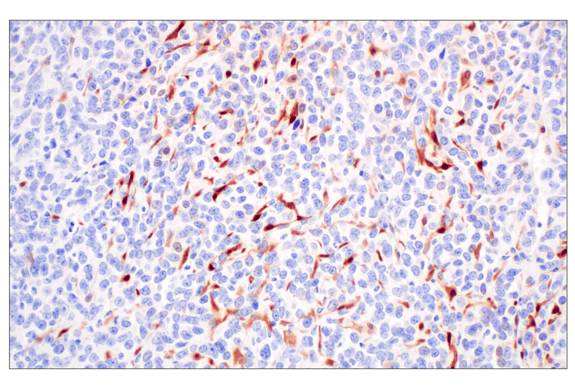 undefined Image 73: Cannabinoid Receptor 1 Downstream Signaling Antibody Sampler Kit