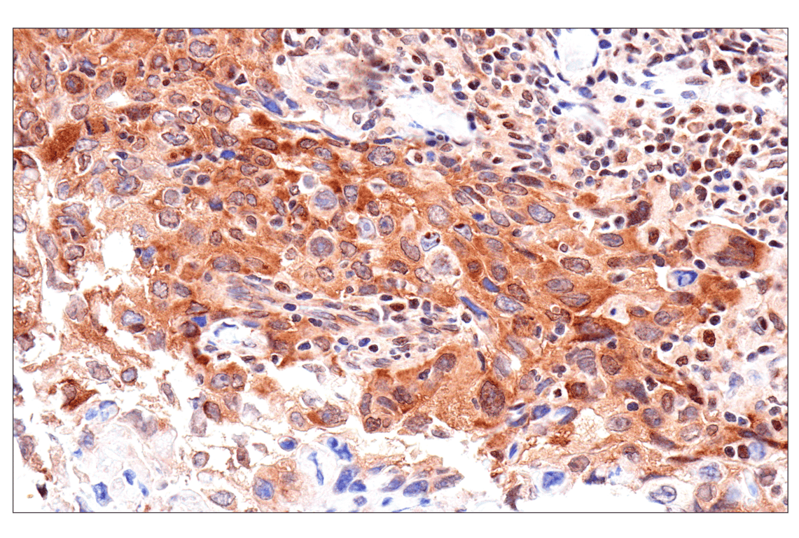 Immunohistochemistry Image 2: ADAR1 p150 Isoform   (E6U1U) Rabbit mAb   (BSA and Azide Free)