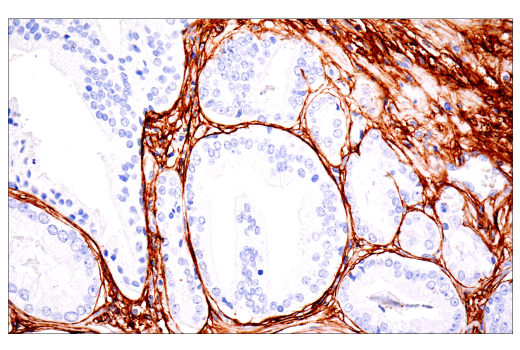 Immunohistochemistry Image 2: COL1A1 (E8F4L) XP<sup>®</sup> Rabbit mAb (BSA and Azide Free)