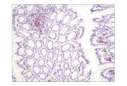 Immunohistochemistry Image 2: Btk (D3H5) Rabbit mAb (BSA and Azide Free)