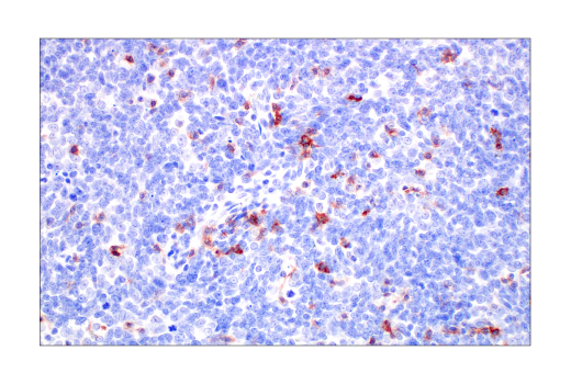 undefined Image 66: Human Exhausted CD8<sup>+</sup> T Cell IHC Antibody Sampler Kit