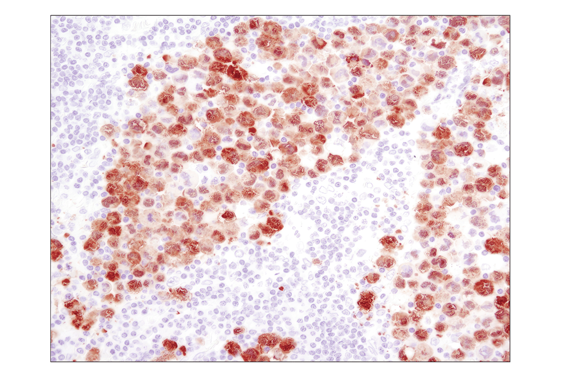 Immunohistochemistry Image 2: ALK (D5F3<sup>®</sup>) XP<sup>®</sup> Rabbit mAb