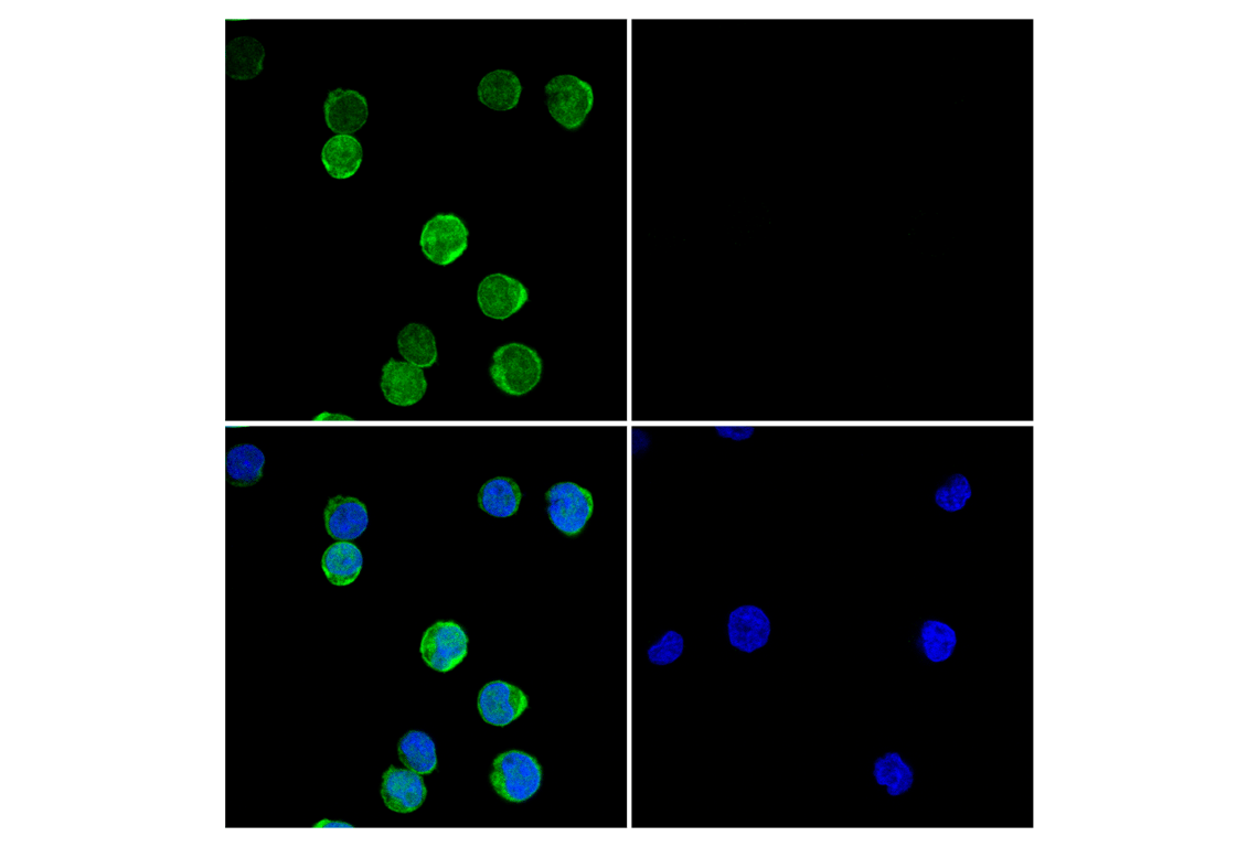 Immunofluorescence Image 1: Zap-70 (D1C10E) XP<sup>®</sup> Rabbit mAb