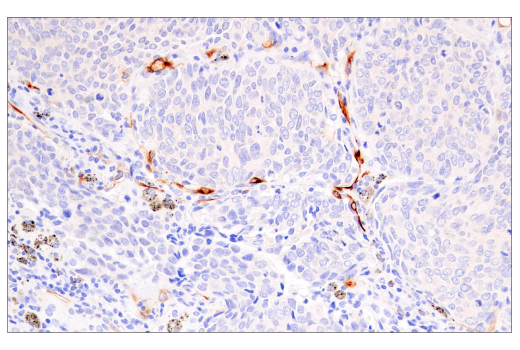 Immunohistochemistry Image 1: HLA-G (E8N9C) XP<sup>®</sup> Rabbit mAb (BSA and Azide Free)