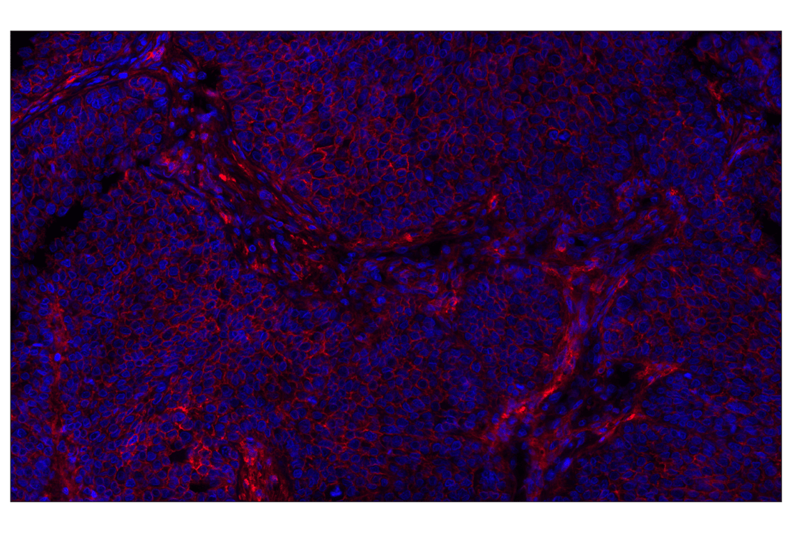 Immunohistochemistry Image 2: CD44 (E7K2Y) XP<sup>®</sup> Rabbit mAb (Alexa Fluor<sup>®</sup> 647 Conjugate)