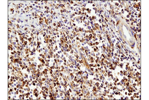 Immunohistochemistry Image 2: VISTA (D1L2G<sup>™</sup>) XP<sup>®</sup> Rabbit mAb (BSA and Azide Free)