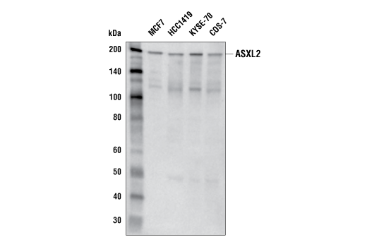 Western Blotting Image 1: ASXL2 (E6Z3X) Rabbit mAb