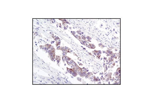 Immunohistochemistry Image 2: γ-Catenin Antibody