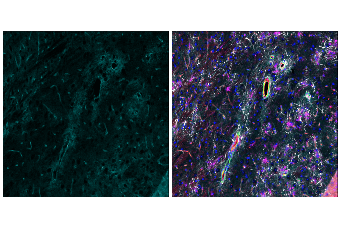 Immunofluorescence Image 4: AQP4 (D1F8E) XP<sup>®</sup> Rabbit mAb (Alexa Fluor<sup>®</sup> 647 Conjugate)