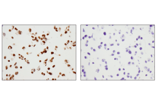 Immunohistochemistry Image 1: Pax6 (D3A9V) XP<sup>®</sup> Rabbit mAb (BSA and Azide Free)