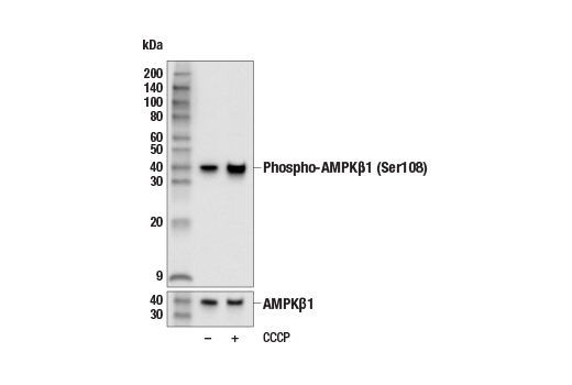 Western Blotting Image 2: Phospho-AMPKβ1 (Ser108) (E8N3N) Rabbit mAb