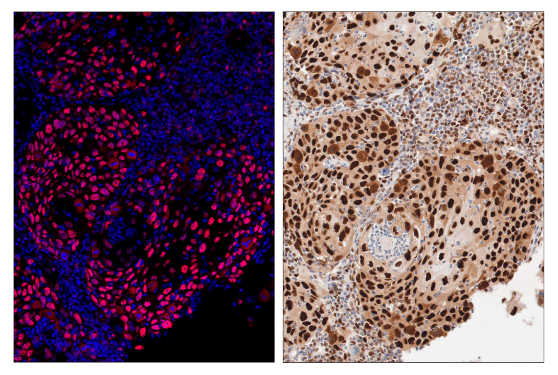 Immunohistochemistry Image 4: PCNA (D3H8P) & CO-0090-488 SignalStar<sup>™</sup> Oligo-Antibody Pair
