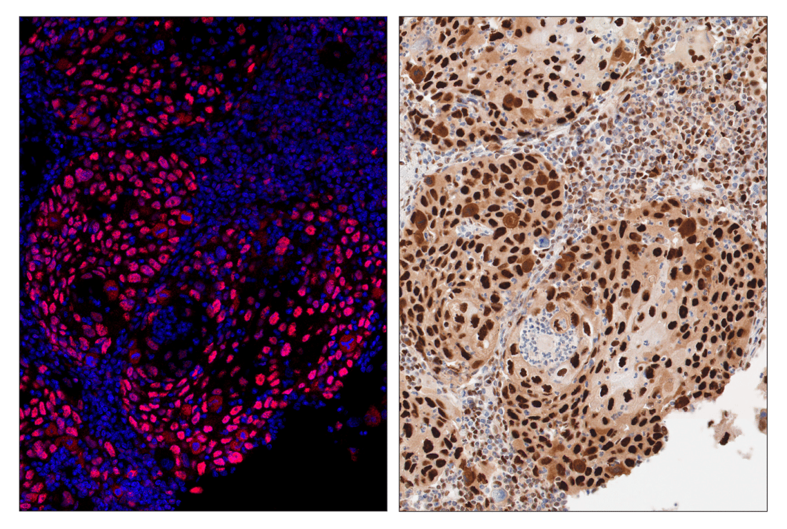 Immunohistochemistry Image 4: PCNA (D3H8P) & CO-0090-594 SignalStar<sup>™</sup> Oligo-Antibody Pair